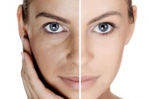 rejuvenecimiento facial