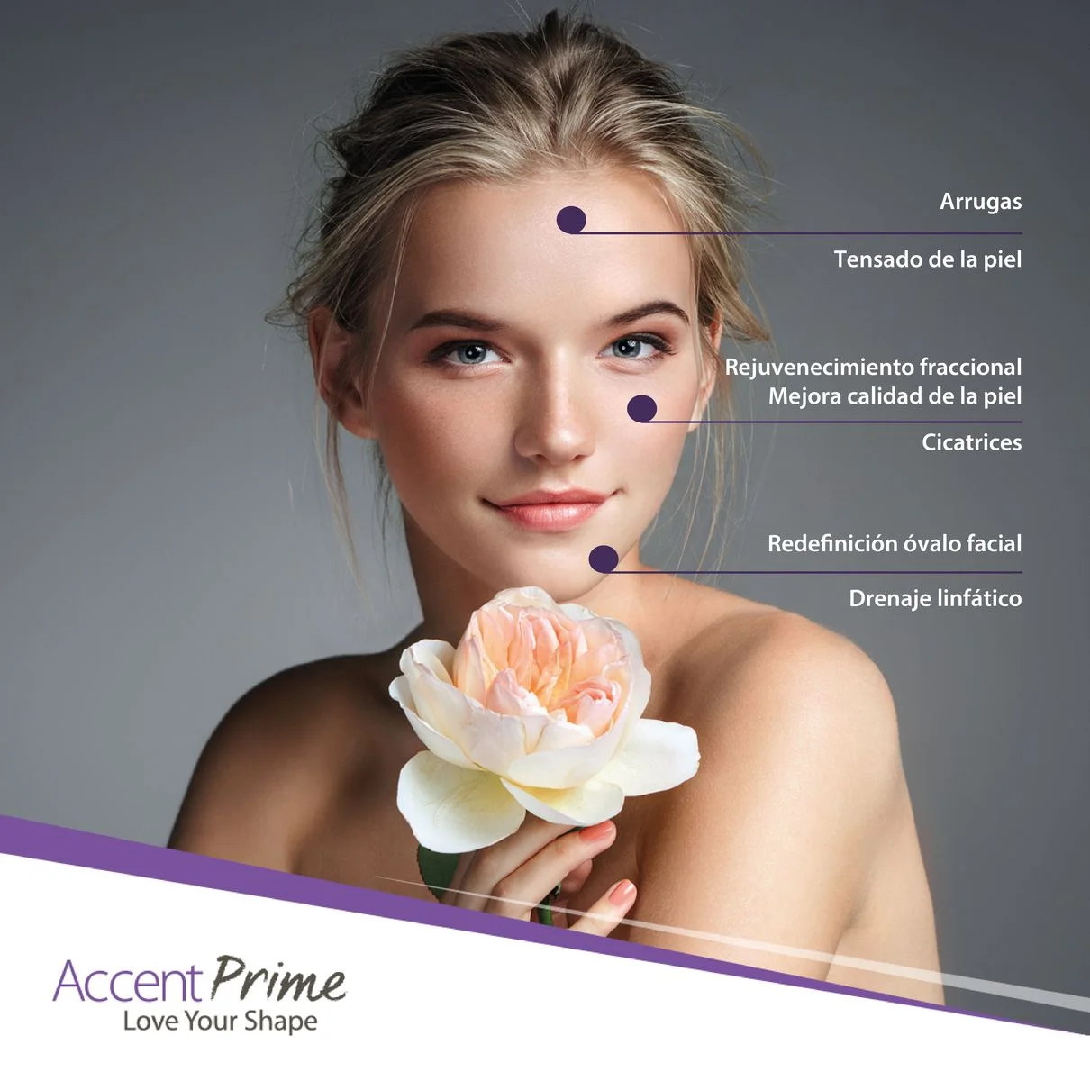 Zonas faciales que trata Accent Prime (imagen del fabricante)