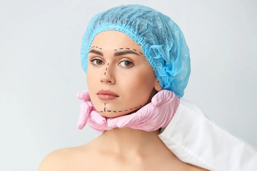 Rostro marcado para un tratamiento de remodelación facial
