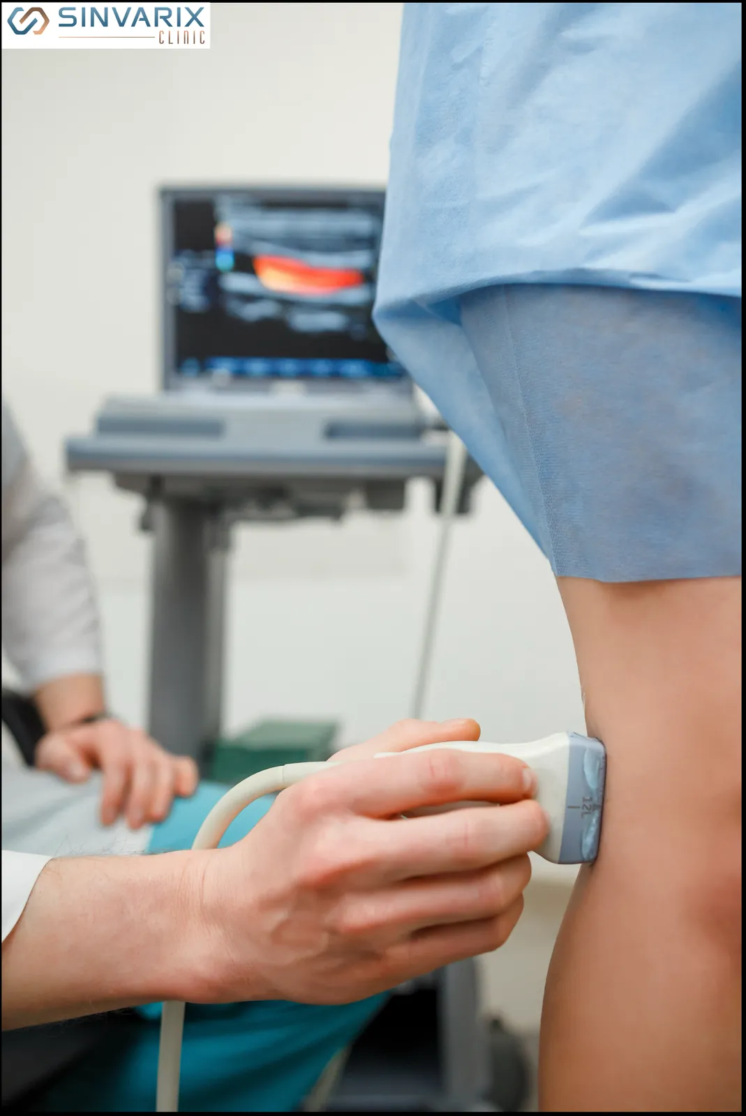 Estudio con ecodoppler de la pierna en SinVarix Clinic